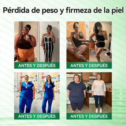 𝑻𝒊𝒆𝒏𝒅𝒂 𝑶𝒇𝒊𝒄𝒊𝒂𝒍 | 👩‍⚕️🌲𝑮𝑳𝑶𝑹𝑬𝐍𝐃𝗔®𝗠𝗼𝗿𝙞𝙣𝙜𝙖 · 𝘽𝙚𝙧𝙗𝙚𝙧𝙞𝙣𝒂 × 𝑵𝑨𝐃+ 𝐏𝐚𝐫𝐜𝙝𝙚 𝘼𝙫𝙖𝙣𝙯𝙖𝙙𝗼 𝗱𝗲 𝗠𝗶𝗰𝗿𝗼𝒏𝒂𝒍𝒈𝒂 𝑵𝒂𝐧𝐨 𝟏0-𝙚𝙣-1(𝐒𝐨𝐥𝐨 𝐮𝐧𝐚 𝐯𝐞𝐳 𝐚𝐥 𝐝í𝐚） ✅ 𝐏𝐚𝐫𝐚 𝐥𝐚 𝐨𝐛𝐞𝐬𝐢𝐝𝐚𝐝, 🅟🅘🅔🅛 🅕🅛🅐🅒🅘🅓🅐, 𝐝𝐢𝐚𝐛𝐞𝐭𝐞𝐬, 𝐚𝐩𝐧𝐞𝐚 𝐝𝐞𝐥 𝐬𝐮𝐞ñ𝐨, 𝐩𝐫𝐨𝐛𝐥𝐞𝐦𝐚𝐬 𝐚𝐫𝐭𝐢𝐜𝐮𝐥𝐚𝐫𝐞𝐬, 𝐲 𝐦𝐮𝐜𝐡𝐨 𝐦á𝐬🎁